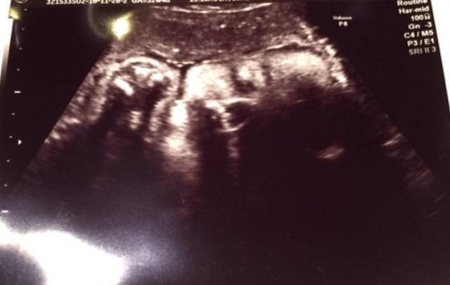 エコー写真 30週1日 30w1d 男の子,妊娠,30週,エコー写真