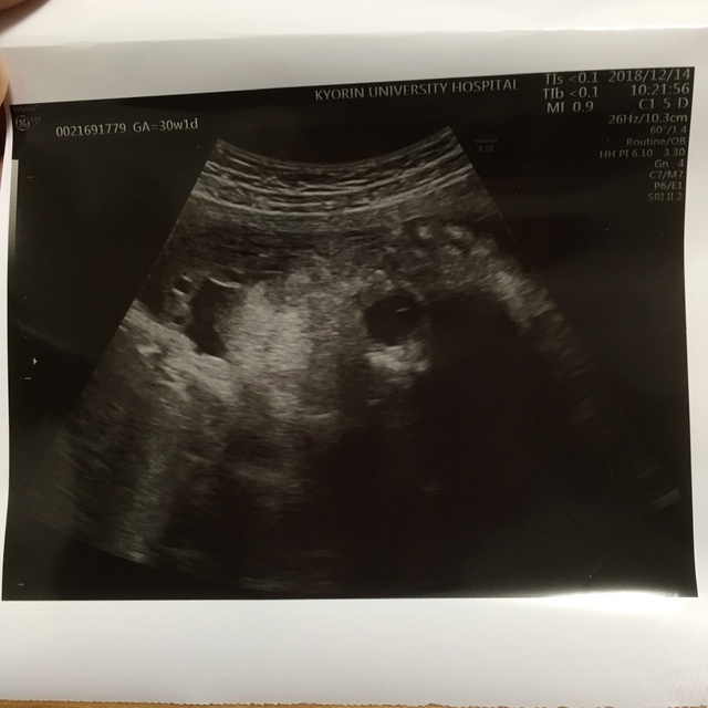 エコー写真 30週1日 30w1d 女の子,妊娠,30週,エコー写真