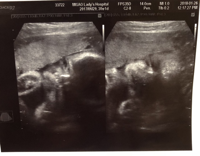 エコー写真 30週1日 30w1d 男の子,妊娠,30週,エコー写真