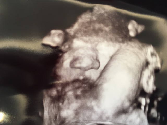 エコー写真 30週3日 30w3d 男の子,妊娠,30週,エコー写真