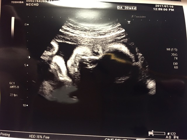 エコー写真 30週4日 30w4d 女の子,妊娠,30週,エコー写真