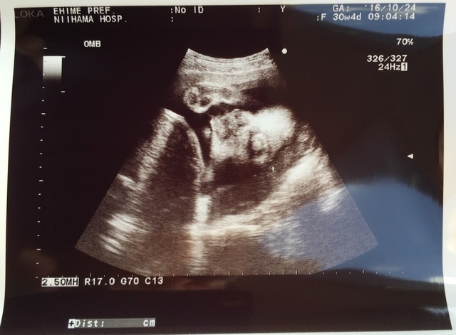 エコー写真 30週4日 30w4d 男の子,妊娠,30週,エコー写真