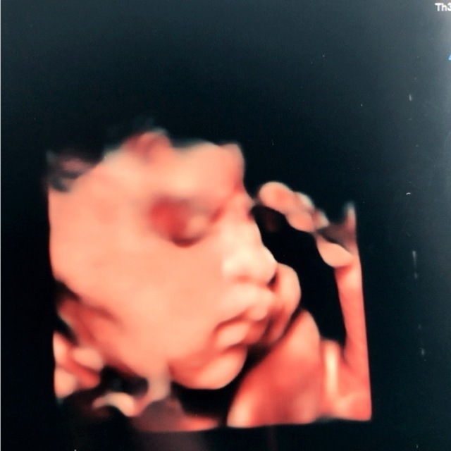 エコー写真 30週4日 30w4d 男の子,妊娠,30週,エコー写真