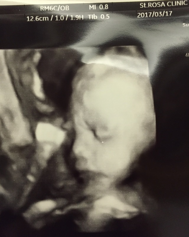 エコー写真 30週4日 30w4d 女の子,妊娠,30週,エコー写真