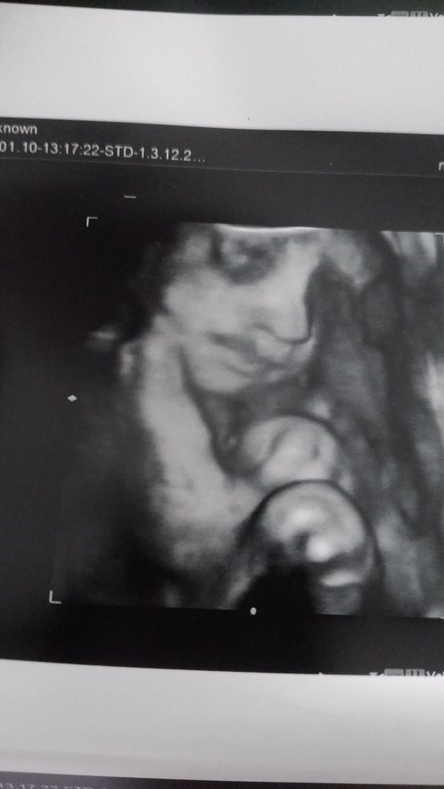 エコー写真 30週4日 30w4d 女の子,妊娠,30週,エコー写真