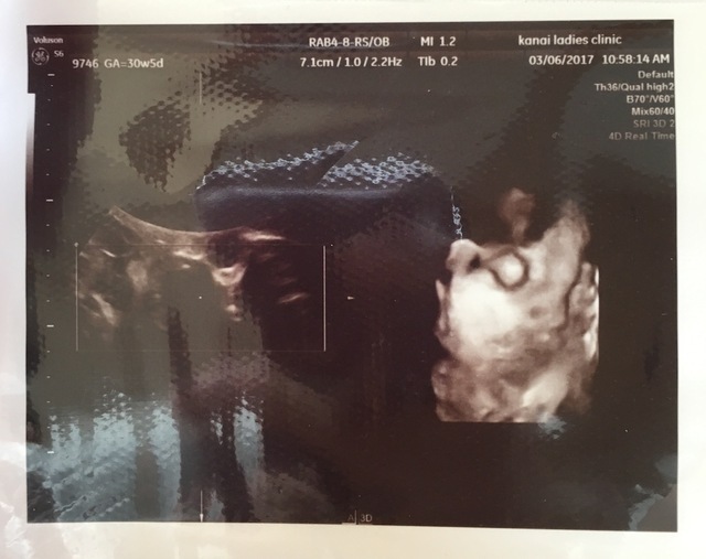 エコー写真 30週5日 30w5d 男の子,妊娠,30週,エコー写真