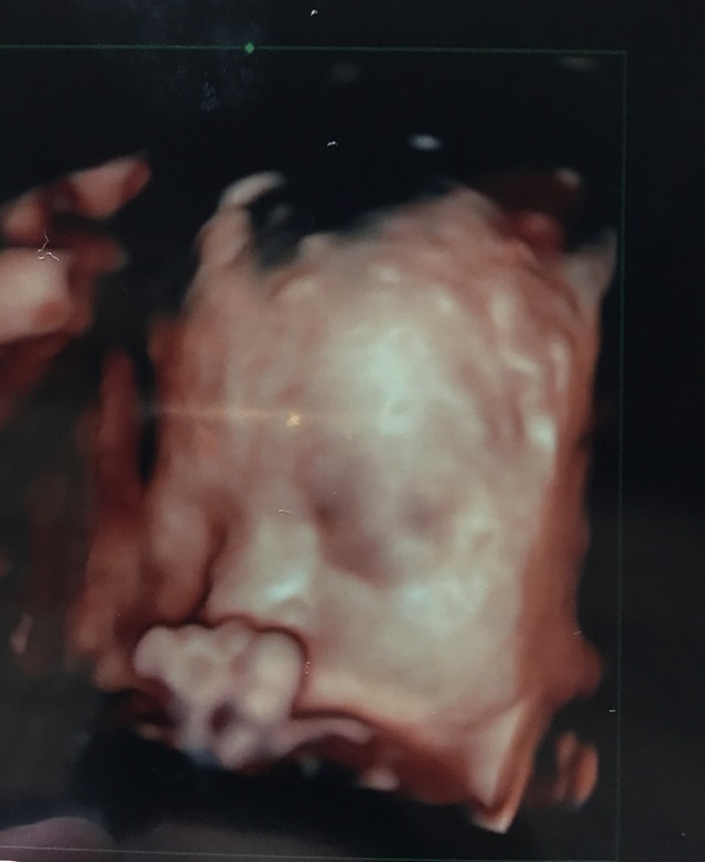 エコー写真 30週5日 30w5d 女の子,妊娠,30週,エコー写真