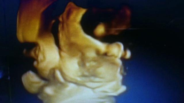 エコー写真 30週5日 30w5d 男の子,妊娠,30週,エコー写真