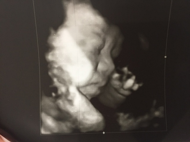 エコー写真 30週5日 30w5d 男の子,妊娠,30週,エコー写真