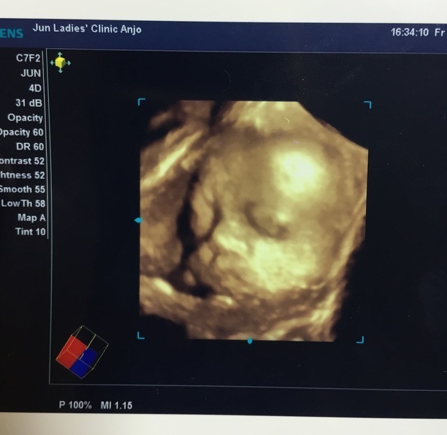 エコー写真 30週6日 30w6d 男の子,妊娠,30週,エコー写真