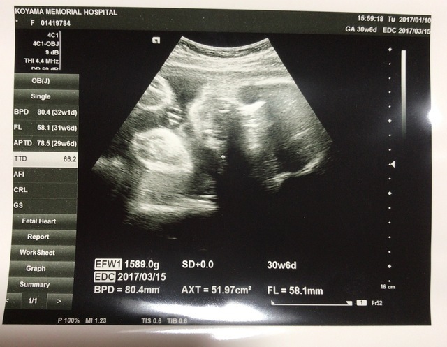 エコー写真 30週6日 30w6d 男の子,妊娠,30週,エコー写真