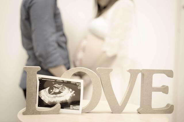 エコー写真 30週4日 30w4d 女の子,妊娠,30週,エコー写真