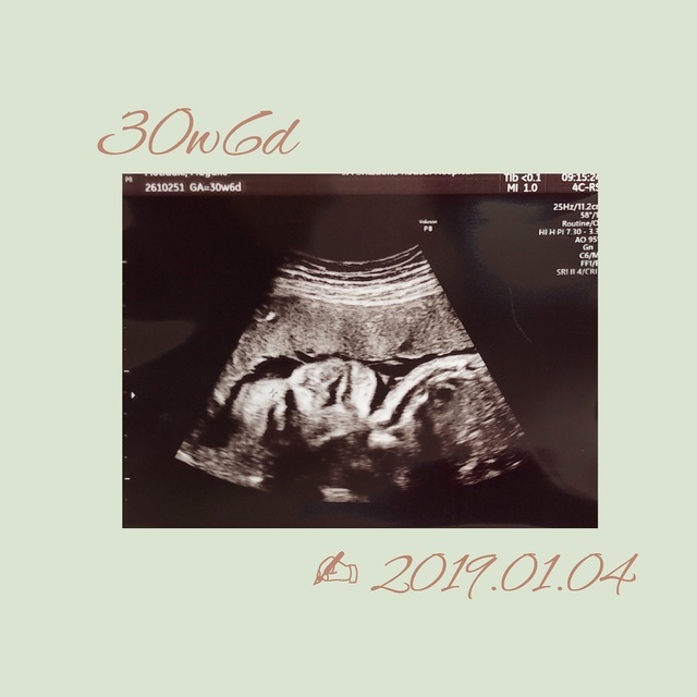エコー写真 30週6日 30w6d 女の子,妊娠,30週,エコー写真