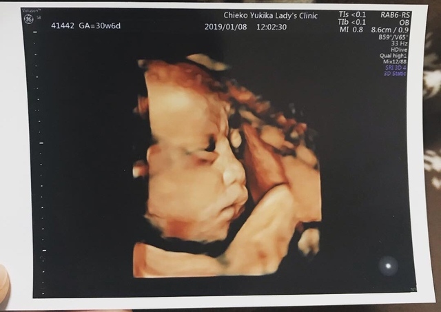 エコー写真 30週6日 30w6d 男の子,妊娠,30週,エコー写真