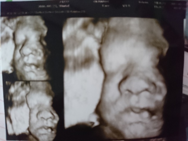 エコー写真 30週6日 30w6d 女の子,妊娠,30週,エコー写真