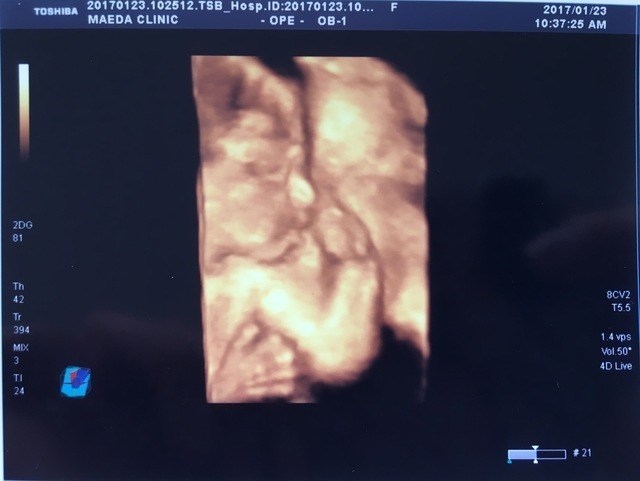 エコー写真 23週0日 23w0d 男の子,妊娠,23週,エコー写真