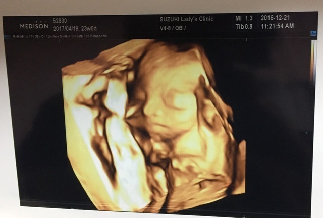 エコー写真 23週0日 23w0d 不明,妊娠,23週,エコー写真