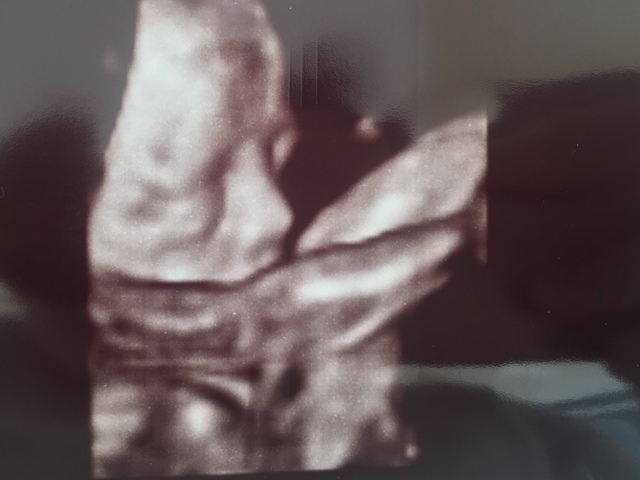 エコー写真 23週0日 23w0d 女の子,妊娠,23週,エコー写真