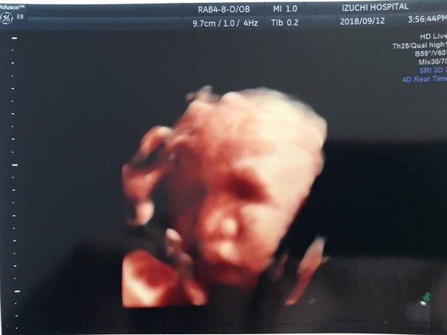 エコー写真 23週0日 23w0d 女の子,妊娠,23週,エコー写真