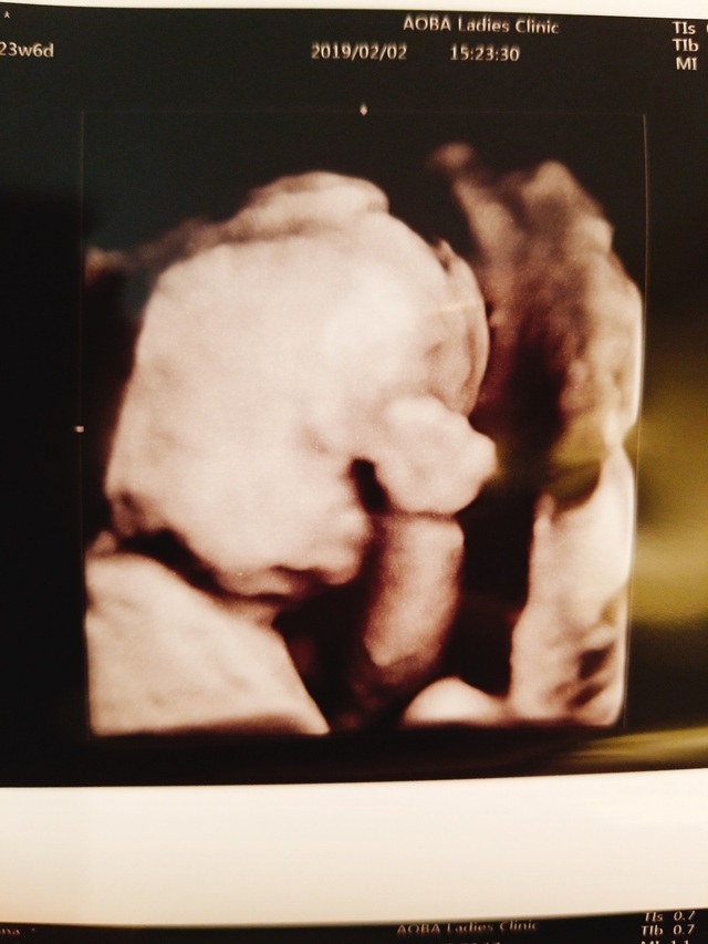 エコー写真 23週1日 23w1d 男の子,妊娠,23週,エコー写真