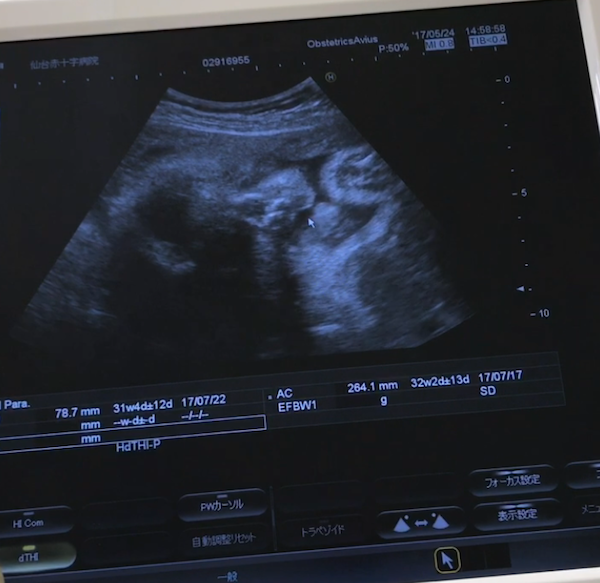 エコー写真 23週2日 23w2d 男の子,妊娠,23週,エコー写真