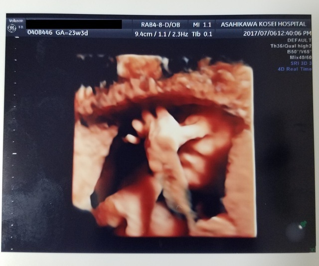 エコー写真 23週3日 23w3d 男の子,妊娠,23週,エコー写真