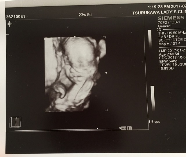 エコー写真 23週5日 23w5d 男の子,妊娠,23週,エコー写真