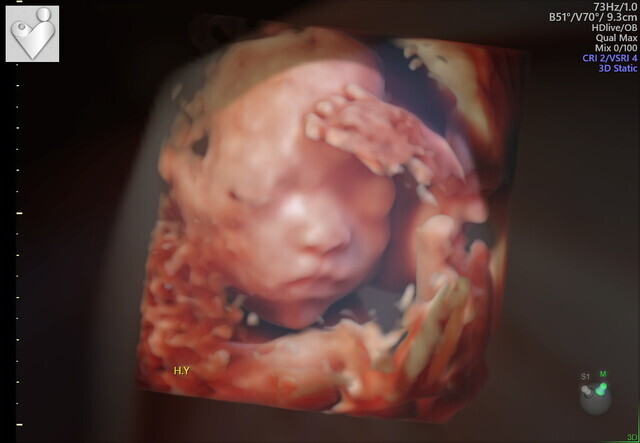 エコー写真 23週5日 23w5d 女の子,妊娠,23週,エコー写真