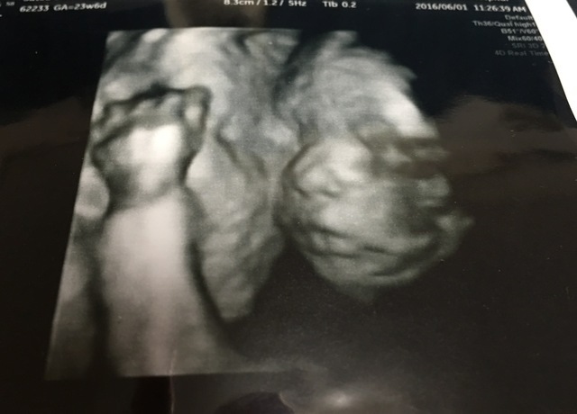 エコー写真 23週6日 23w6d 男の子,妊娠,23週,エコー写真