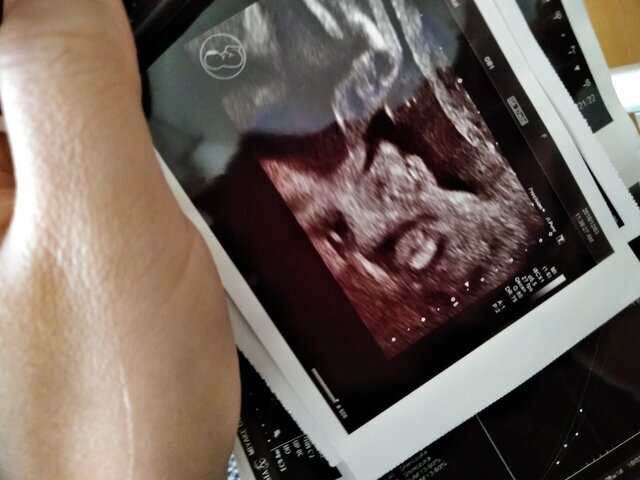 エコー写真 35週0日 35w0d 女の子,妊娠,35週,エコー写真