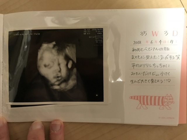 エコー写真 35週3日 35w3d 女の子,妊娠,35週,エコー写真