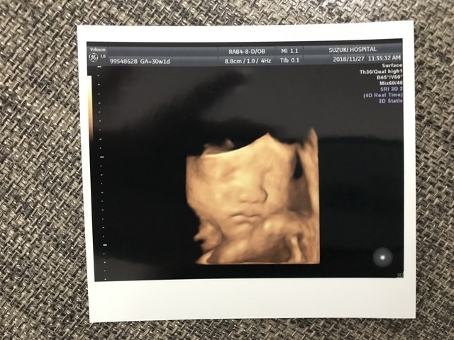 エコー写真 35週6日 35w6d 男の子,妊娠,35週,エコー写真