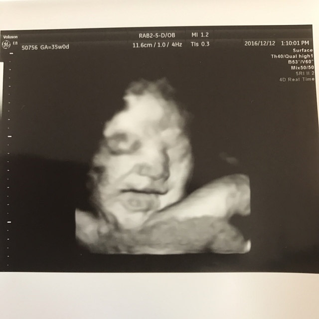 エコー写真 35週0日 35w0d 男の子,妊娠,35週,エコー写真