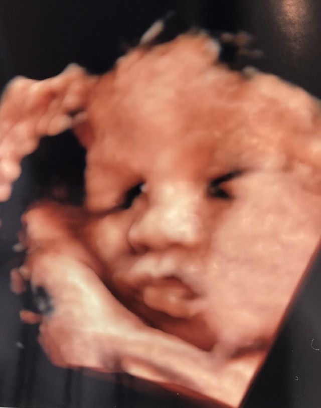 エコー写真 35週2日 35w2d 女の子,妊娠,35週,エコー写真