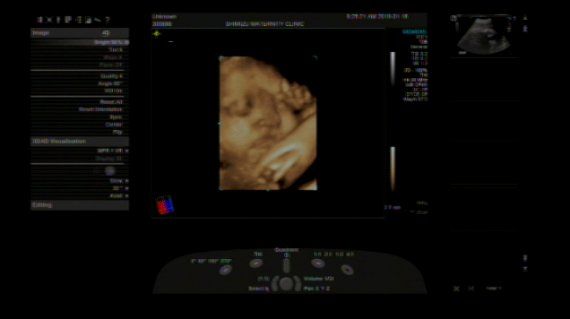 エコー写真 32週1日 32w1d 男の子,妊娠,32週,エコー写真