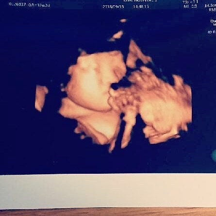 エコー写真 32週2日 32w2d 女の子,妊娠,32週,エコー写真