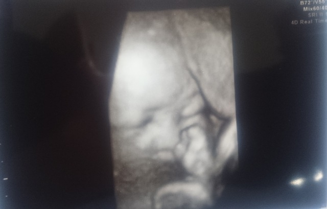 エコー写真 32週4日 32w4d 女の子,妊娠,32週,エコー写真