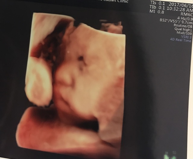 エコー写真 32週4日 32w4d 女の子,妊娠,32週,エコー写真