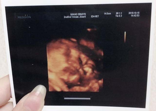 エコー写真 32週4日 32w4d 女の子,妊娠,32週,エコー写真