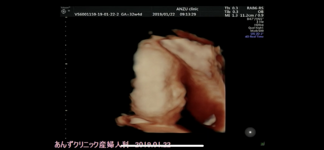 エコー写真 32週4日 32w4d 女の子,妊娠,32週,エコー写真