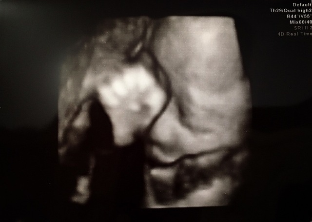 エコー写真 32週6日 32w6d 男の子,妊娠,32週,エコー写真