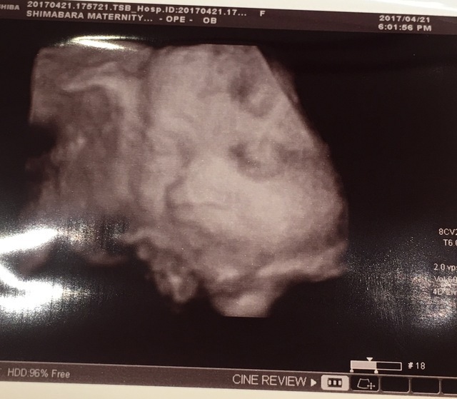 エコー写真 32週0日 32w0d 男の子,妊娠,32週,エコー写真