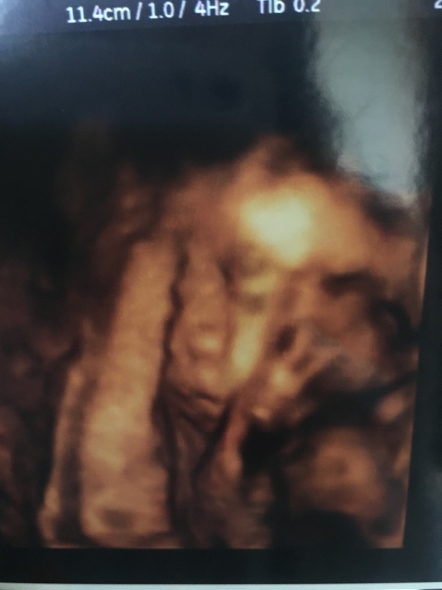 エコー写真 32週5日 32w5d 男の子,妊娠,32週,エコー写真