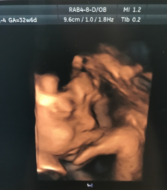 エコー写真 32週6日 32w6d 男の子,妊娠,32週,エコー写真