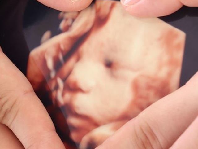 エコー写真 34週0日 34w0d 男の子,妊娠,34週,エコー写真