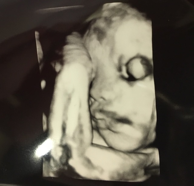 エコー写真 34週2日 34w2d 女の子,妊娠,34週,エコー写真