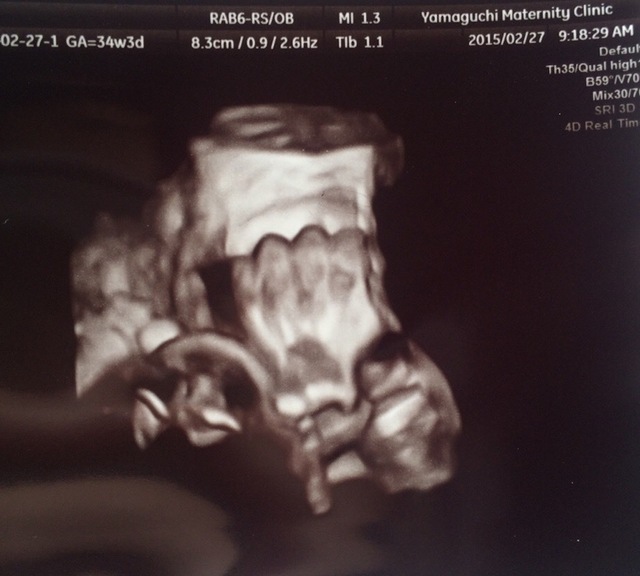 エコー写真 34週3日 34w3d 男の子,妊娠,34週,エコー写真