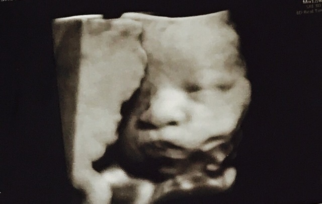 エコー写真 34週3日 34w3d 女の子,妊娠,34週,エコー写真