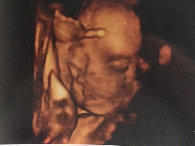 エコー写真 34週3日 34w3d 女の子,妊娠,34週,エコー写真