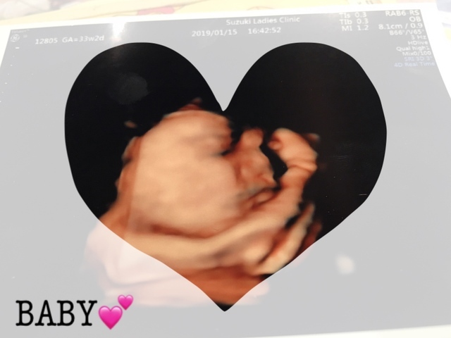 エコー写真 34週3日 34w3d 男の子,妊娠,34週,エコー写真